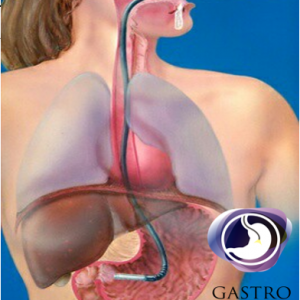 Gastroscopia