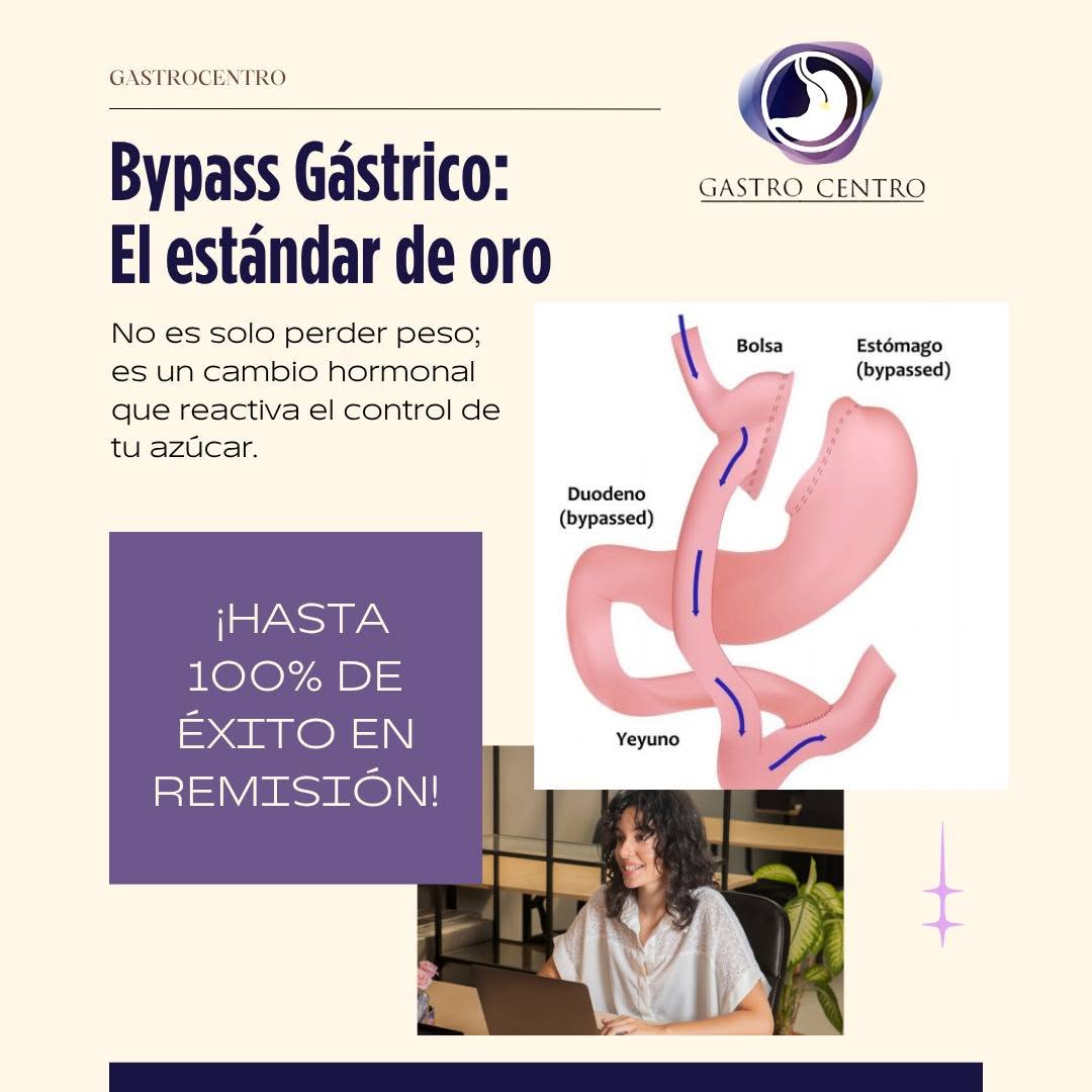 Bypass Gástrico