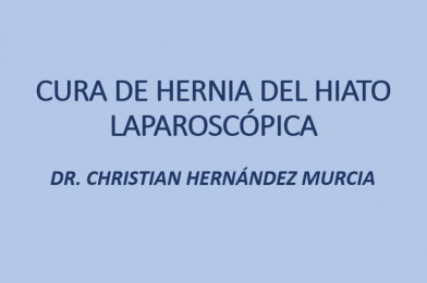 Cura de hernia del Hiato Laparoscópica (Cirugía Anti-reflujo)